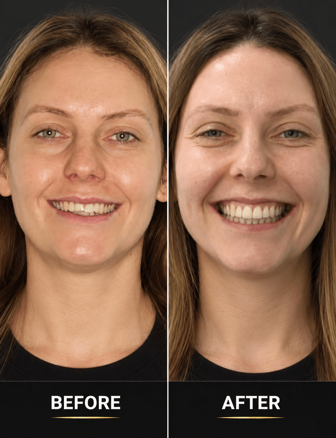 Always Smile Dental - Elmhurst, Queens, New York 5