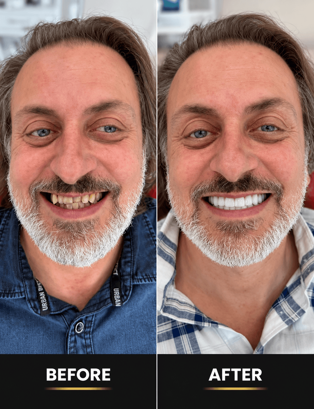 Always Smile Dental - Elmhurst, Queens, New York 7