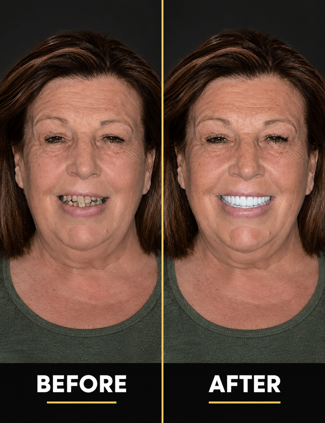 Always Smile Dental - Elmhurst, Queens, New York 9