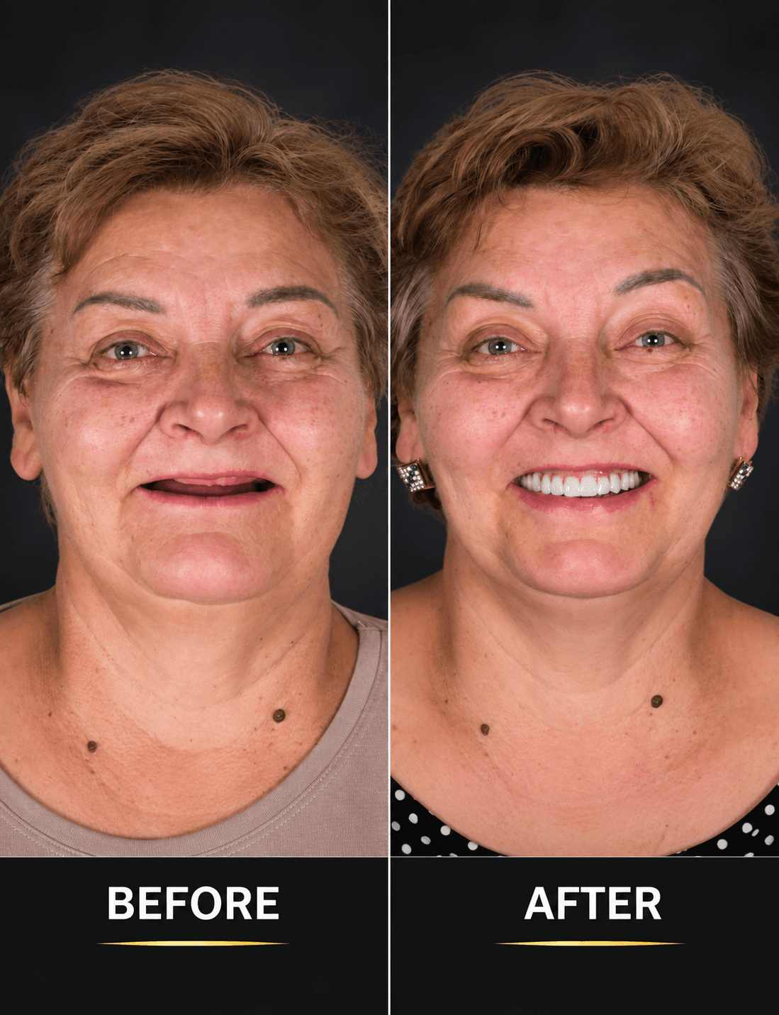 Always-Smile-Dental-Elmhurst-Queens-New-York-10