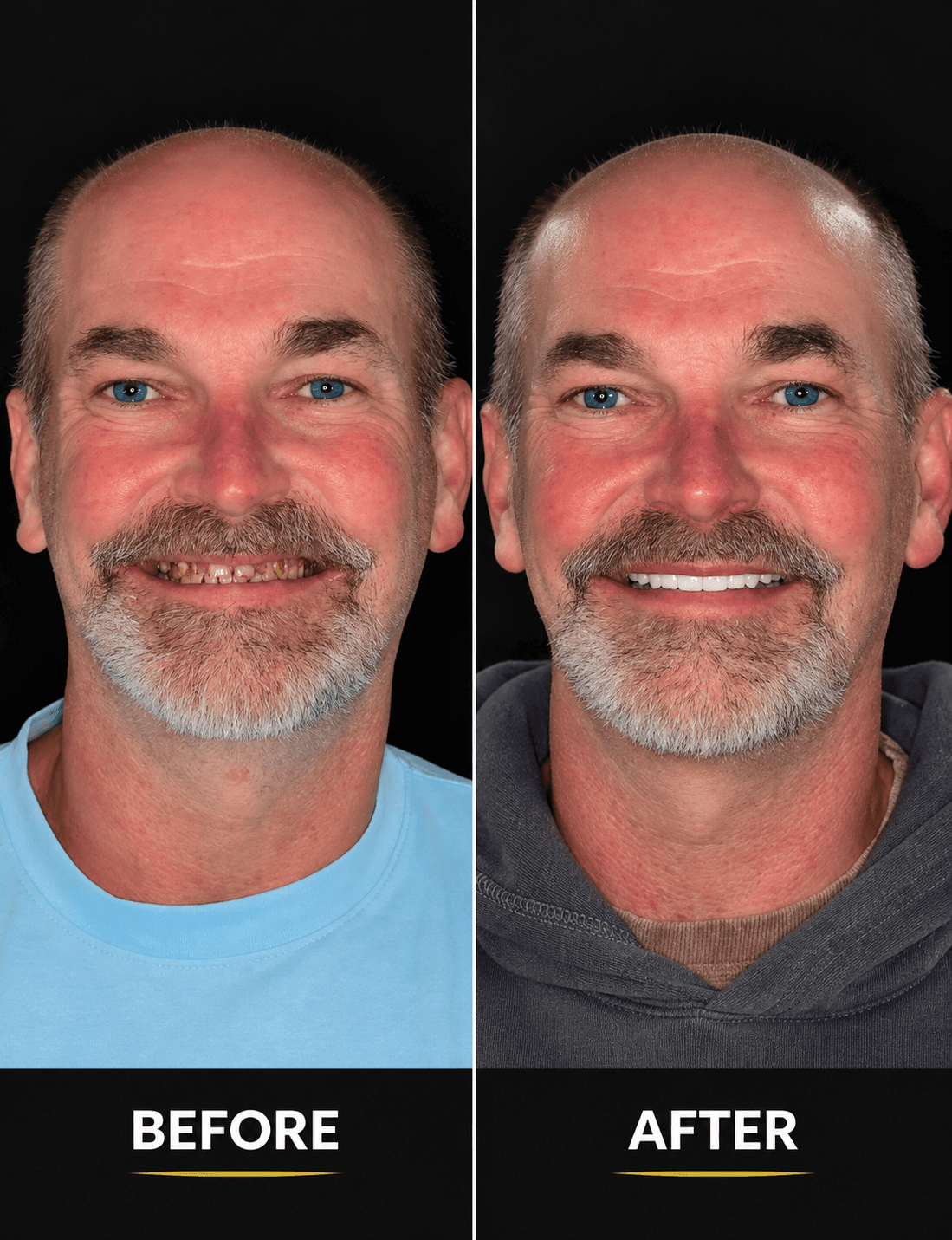 Always-Smile-Dental-Elmhurst-Queens-New-York-8