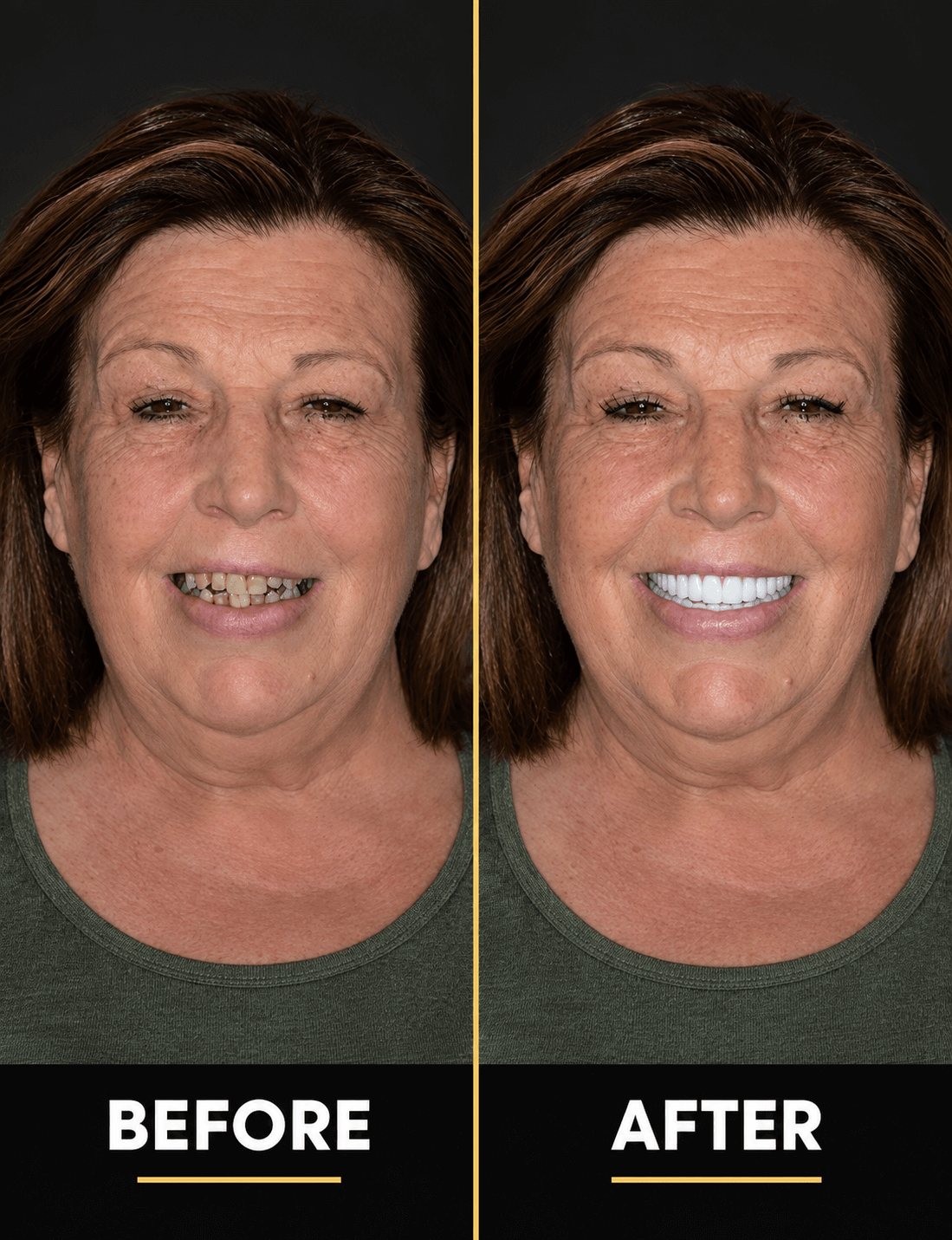 Always-Smile-Dental-Elmhurst-Queens-New-York-9